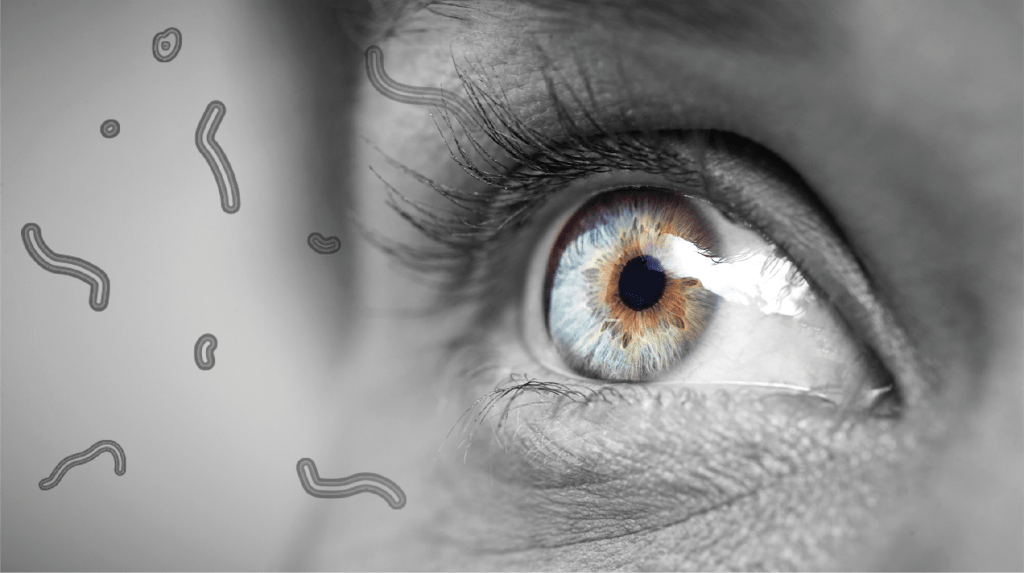 eye floaters treatment
